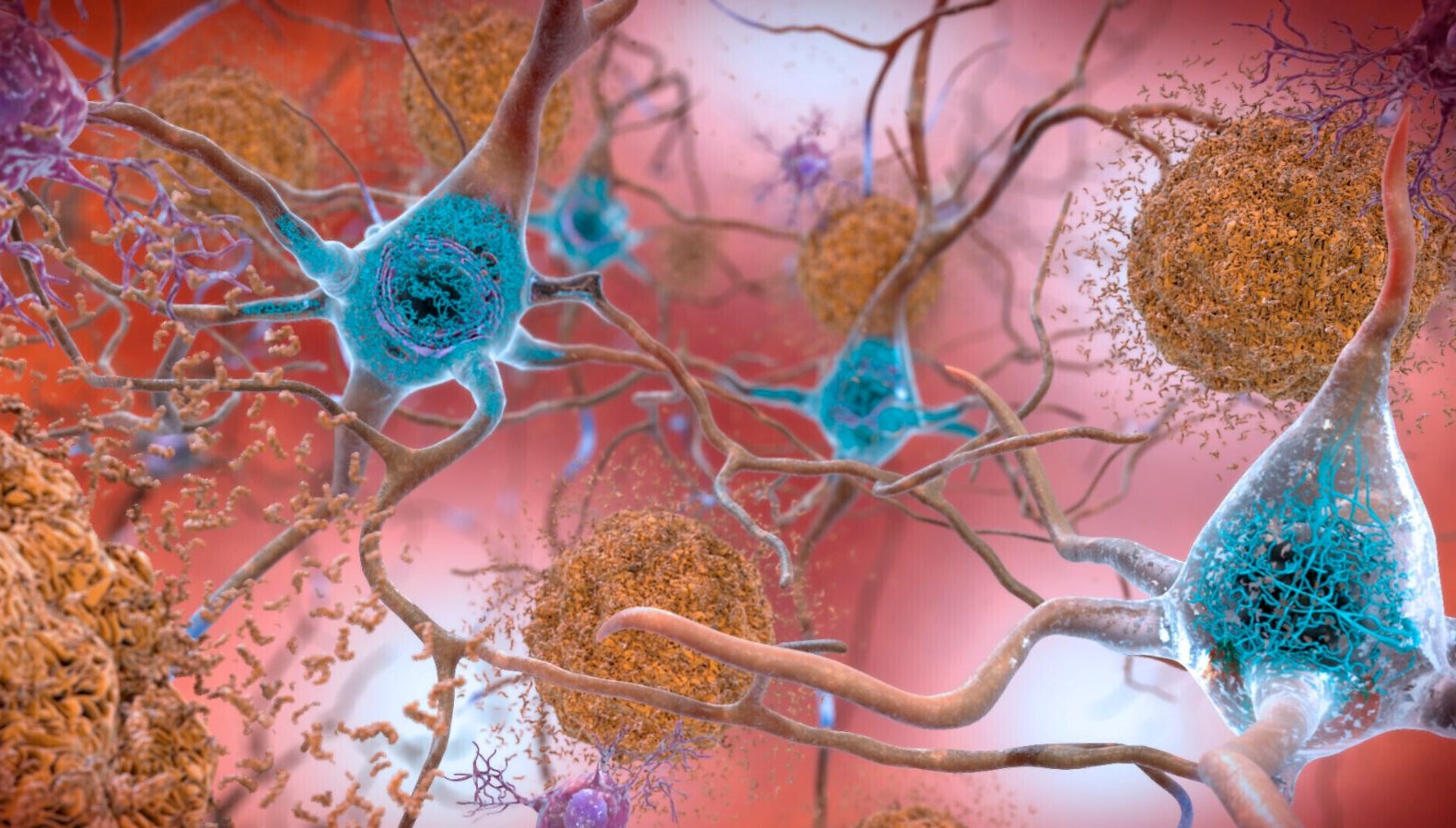 arastirmacilardan alzheimera karsi yeni yontem shield nedir 2Rnp6bHi